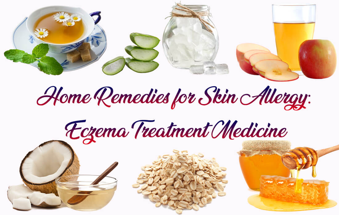 Home Remedies for Skin Allergy: Eczema Treatment Medicine